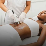Ultrasonic Cavitation Fat Melting in May Pen Jamaica