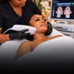 Non-Surgical Ultherapy Skin Lifting in May Pen Jamaica